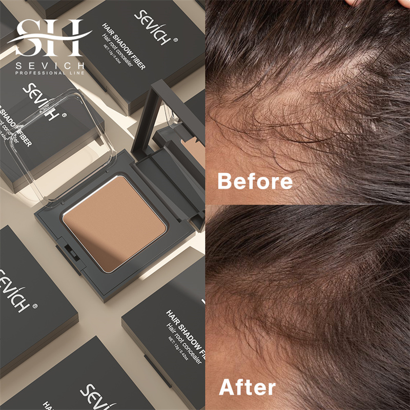 SEVICH 12g Hairline Powder Wit - Rooting Hormone Powder のレビューと価格