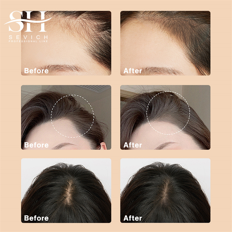 SEVICH 12g Hairline Powder Wit - Rooting Hormone Powder のレビューと価格