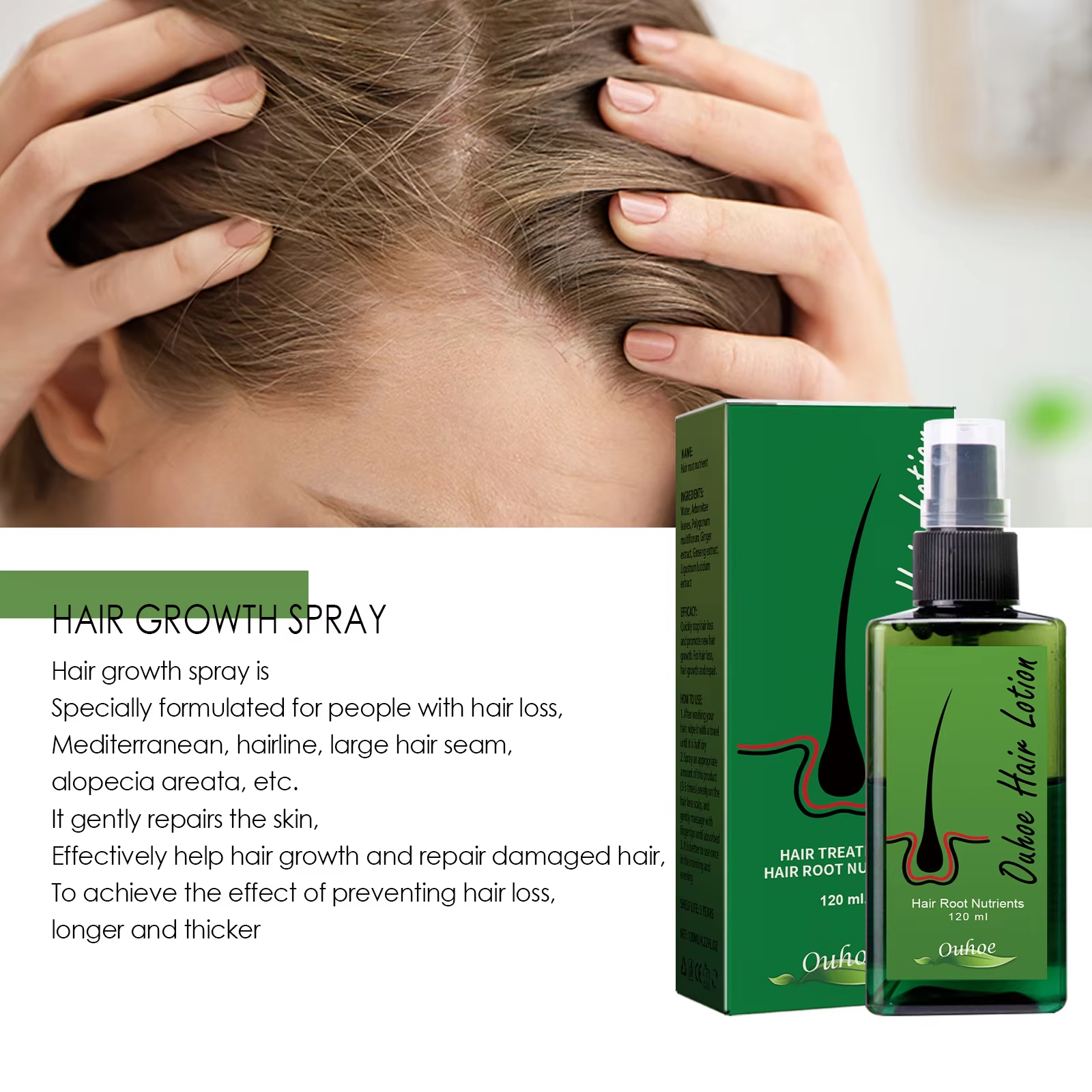 Hair Growth Spray Anti Hair Lo - Root Stimulator Liquid のレビューと価格